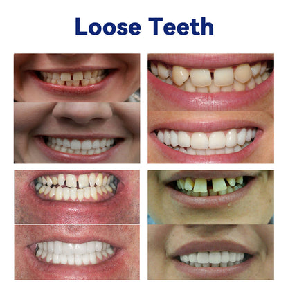 𝐵𝑖𝑘𝑒𝑛𝑑𝑎® 𝑆𝑖𝑙𝑖𝑐𝑜𝑛𝑒 𝐷𝑒𝑛𝑡𝑢𝑟𝑒 𝑅𝑢𝑙𝑒𝑟 𝑆𝑒𝑡 (✅✅✅ Tested, Trusted, and Dentist-Recommended）